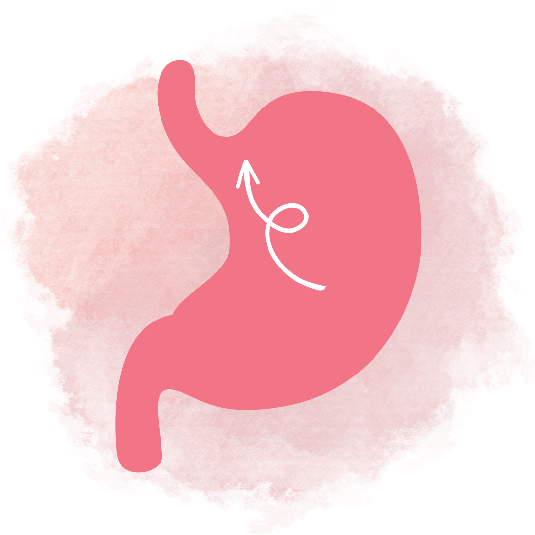 위장 식도 역류성